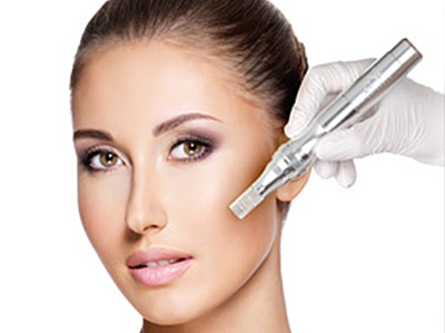 Micro Needling by CNC